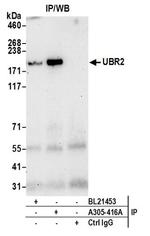 UBR2 Antibody in Western Blot (WB)