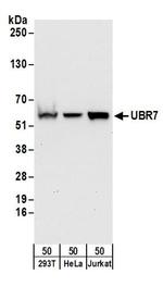 UBR7 Antibody in Western Blot (WB)