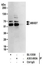 UBXD7 Antibody in Western Blot (WB)