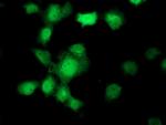 UBXN2B Antibody in Immunocytochemistry (ICC/IF)