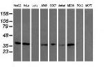 UBXN2B Antibody in Western Blot (WB)