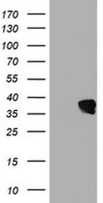 UBXN2B Antibody in Western Blot (WB)