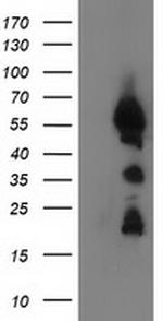 UBXN2B Antibody in Western Blot (WB)