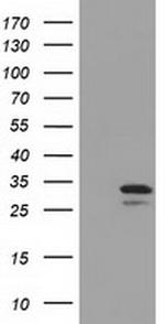 UCK1 Antibody in Western Blot (WB)