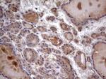 UFD1L Antibody in Immunohistochemistry (Paraffin) (IHC (P))