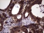 UFD1L Antibody in Immunohistochemistry (Paraffin) (IHC (P))