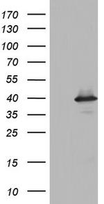 UFD1L Antibody in Western Blot (WB)