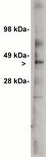 UGCG Antibody in Western Blot (WB)