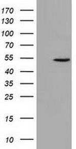 UHMK1 Antibody in Western Blot (WB)