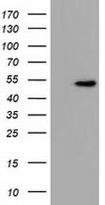 UHMK1 Antibody in Western Blot (WB)
