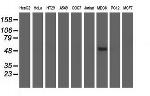 UHMK1 Antibody in Western Blot (WB)