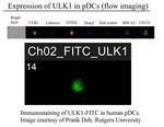 ULK1 Antibody in Immunocytochemistry (ICC/IF)