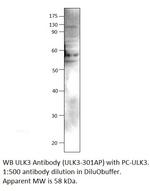 ULK3 Antibody in Western Blot (WB)