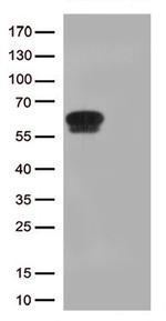 GPA33 Antibody in Western Blot (WB)