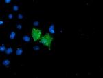 UNG Antibody in Immunocytochemistry (ICC/IF)