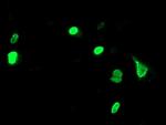 UNG Antibody in Immunocytochemistry (ICC/IF)