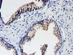 UNG Antibody in Immunohistochemistry (Paraffin) (IHC (P))