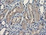 UNG Antibody in Immunohistochemistry (Paraffin) (IHC (P))