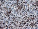 UNG Antibody in Immunohistochemistry (Paraffin) (IHC (P))