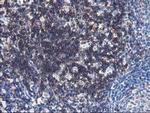 UNG Antibody in Immunohistochemistry (Paraffin) (IHC (P))