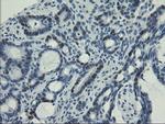 UNG Antibody in Immunohistochemistry (Paraffin) (IHC (P))