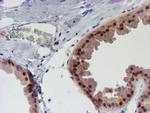 UNG Antibody in Immunohistochemistry (Paraffin) (IHC (P))