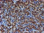 UNG Antibody in Immunohistochemistry (Paraffin) (IHC (P))