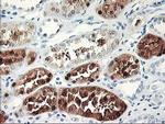 UNG Antibody in Immunohistochemistry (Paraffin) (IHC (P))