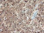 UNG Antibody in Immunohistochemistry (Paraffin) (IHC (P))