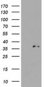 UNG Antibody in Western Blot (WB)