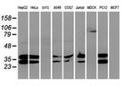 UNG Antibody in Western Blot (WB)