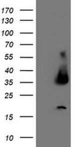 UNG Antibody in Western Blot (WB)