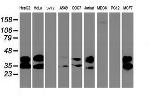 UNG Antibody in Western Blot (WB)