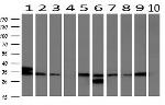 UNG Antibody in Western Blot (WB)