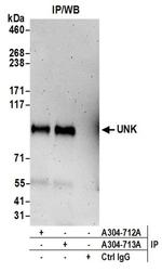 UNK Antibody in Immunoprecipitation (IP)