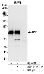 UNK Antibody in Western Blot (WB)