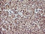 UPRT Antibody in Immunohistochemistry (Paraffin) (IHC (P))