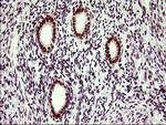 UPRT Antibody in Immunohistochemistry (Paraffin) (IHC (P))