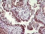 UPRT Antibody in Immunohistochemistry (Paraffin) (IHC (P))