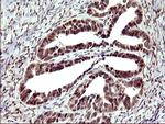 UPRT Antibody in Immunohistochemistry (Paraffin) (IHC (P))