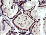 UPRT Antibody in Immunohistochemistry (Paraffin) (IHC (P))