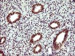 UPRT Antibody in Immunohistochemistry (Paraffin) (IHC (P))