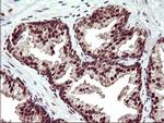 UPRT Antibody in Immunohistochemistry (Paraffin) (IHC (P))