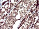 UPRT Antibody in Immunohistochemistry (Paraffin) (IHC (P))