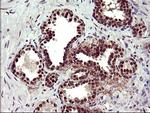 UPRT Antibody in Immunohistochemistry (Paraffin) (IHC (P))