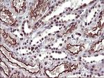 UPRT Antibody in Immunohistochemistry (Paraffin) (IHC (P))