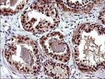 UPRT Antibody in Immunohistochemistry (Paraffin) (IHC (P))