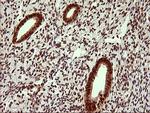 UPRT Antibody in Immunohistochemistry (Paraffin) (IHC (P))