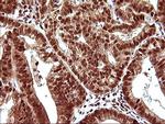 UPRT Antibody in Immunohistochemistry (Paraffin) (IHC (P))