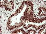 UPRT Antibody in Immunohistochemistry (Paraffin) (IHC (P))